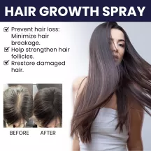 Ouhoe Hair Growth Spray