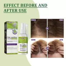 OUHOE Hair Growth Nutrient