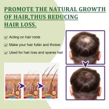 OUHOE Hair Growth Nutrient