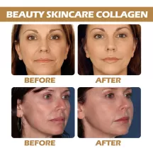 OUHOE Collagen Anti Wrinkle Serum