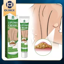 OUHOE Lipoma Removal Cream