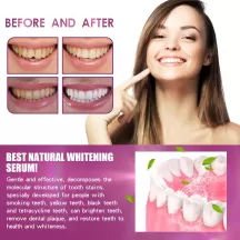 OUHOE Teeth Whitening Essence