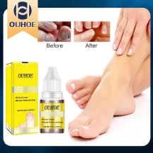 OUHOE Nail Repair Oil