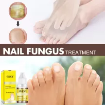 OUHOE Nail Repair Oil