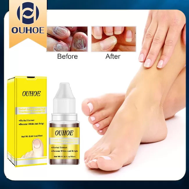 OUHOE Nail Repair Oil