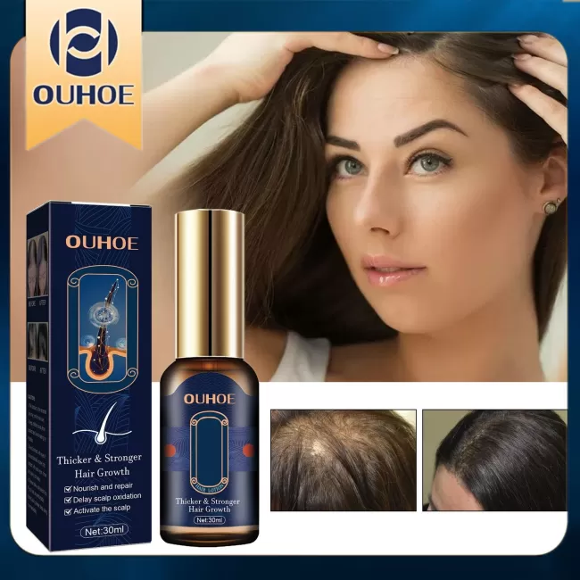 OUHOE Hair Growth Essential Oil