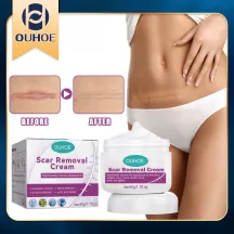 ouhoe scar removal cream