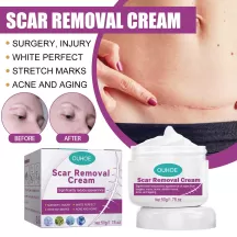 ouhoe scar removal cream