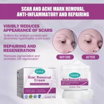 ouhoe scar removal cream