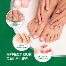 OUHOE Nail Fungal Treatment Serum