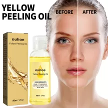 OUHOE Yellow Peeling Oil