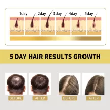 OUHOE Ginger Shampoo Hair Growth